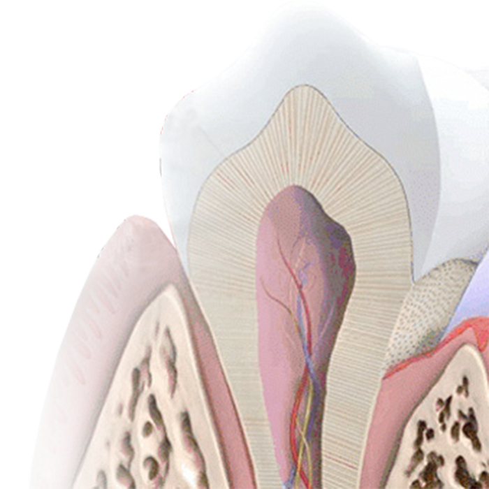 Dentin Hypersensitivity; Current Concepts in the Management of a Common Problem