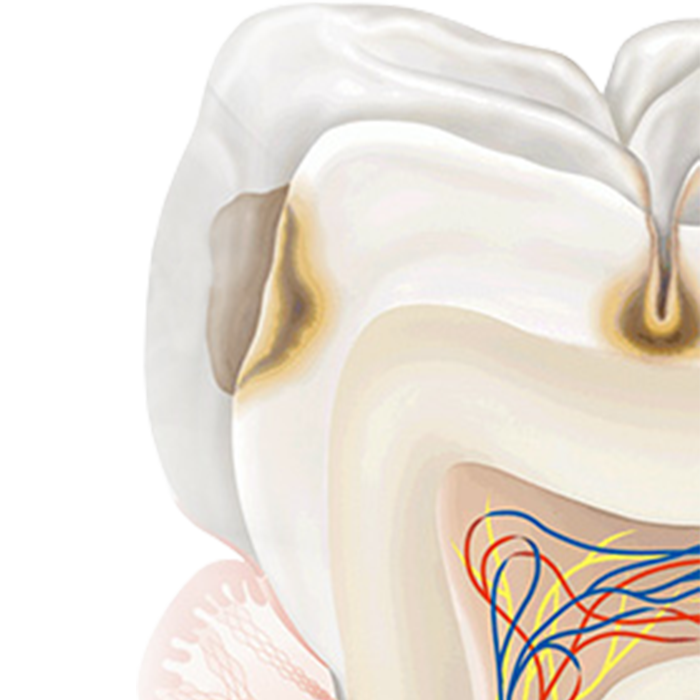 Prevent and Protect Oral Health for a Lifetime