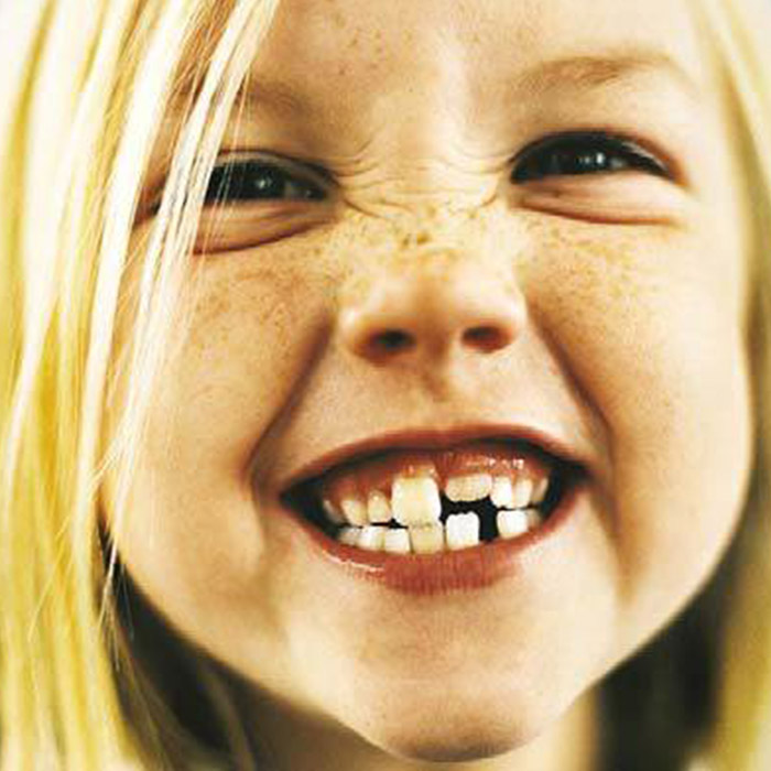 Prevent and Protect: Improving Children’s Oral Health