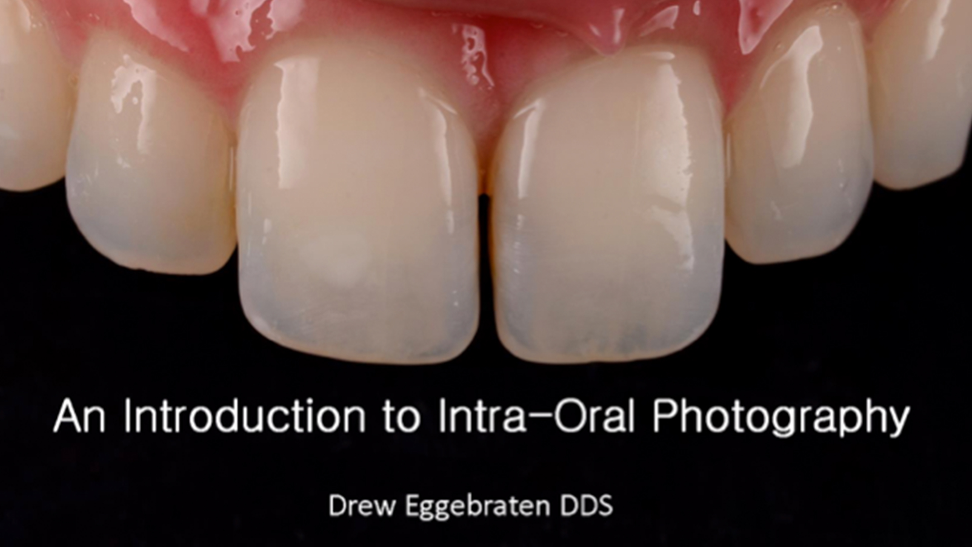An Introduction to Intra-Oral Photography