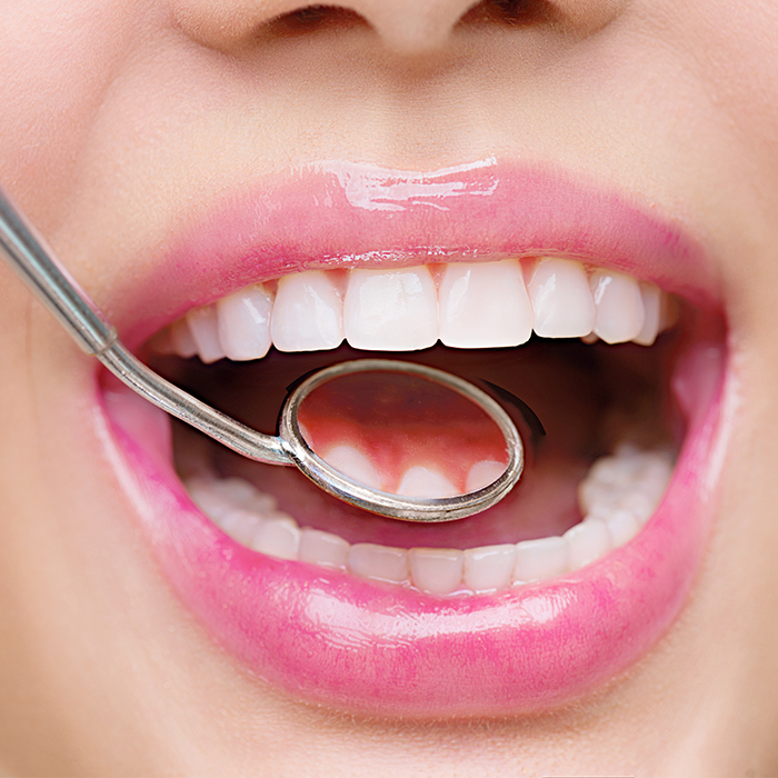 Achieving Whole Mouth Health
