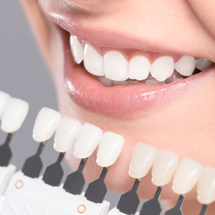 The Science of Whitening