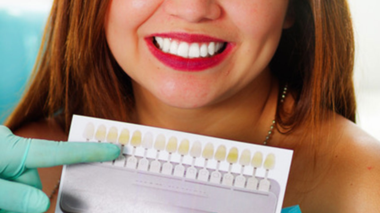 Whitening as a Practice Builder: A Conversation with the Experts
