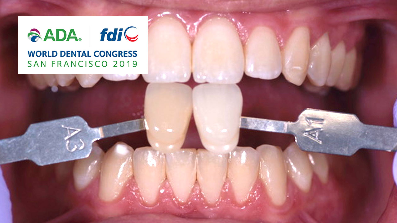 Whitening as a Practice Builder:  New Options Utilizing Ionic Technology