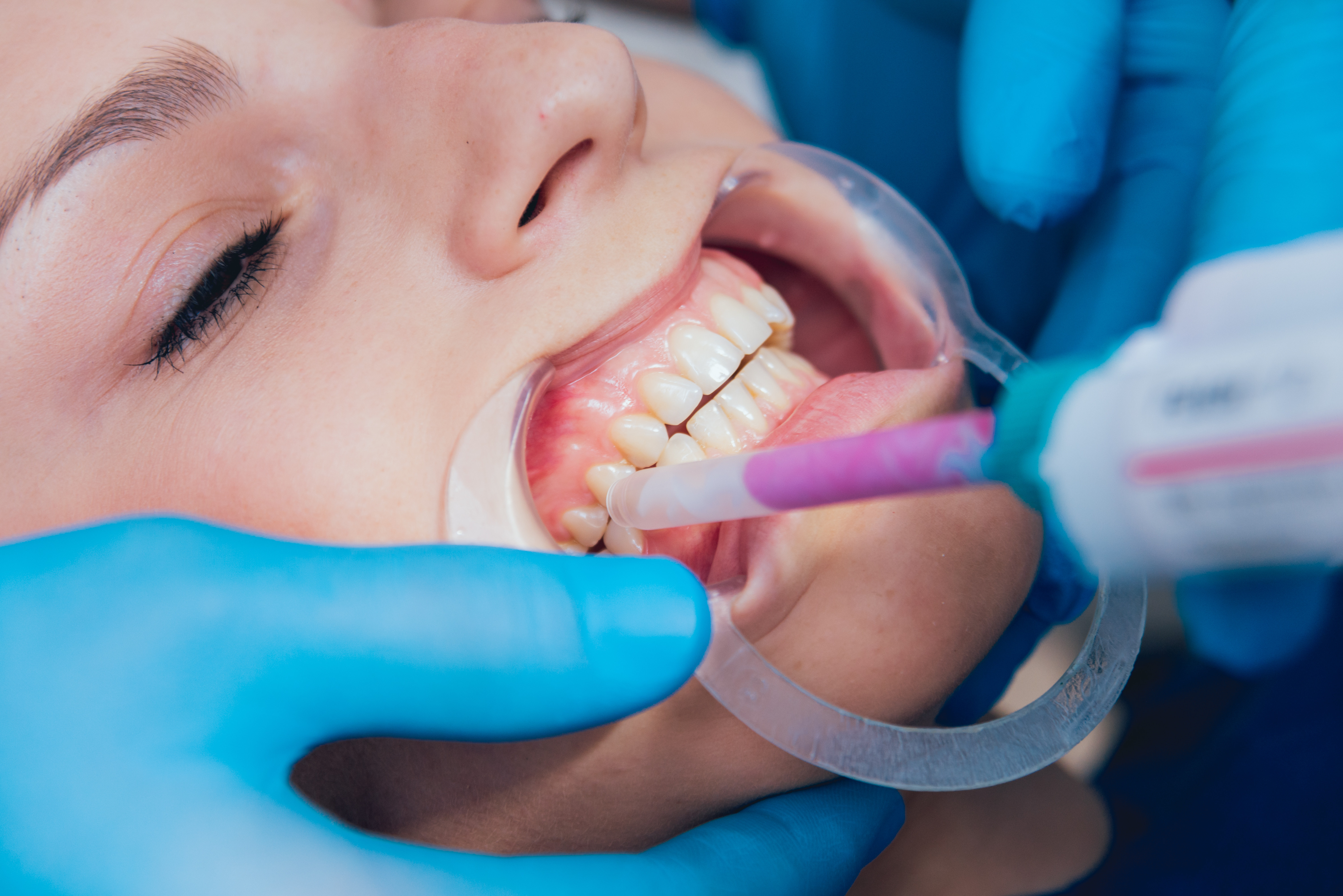 Occlusion, Mastication and Cognitive Function