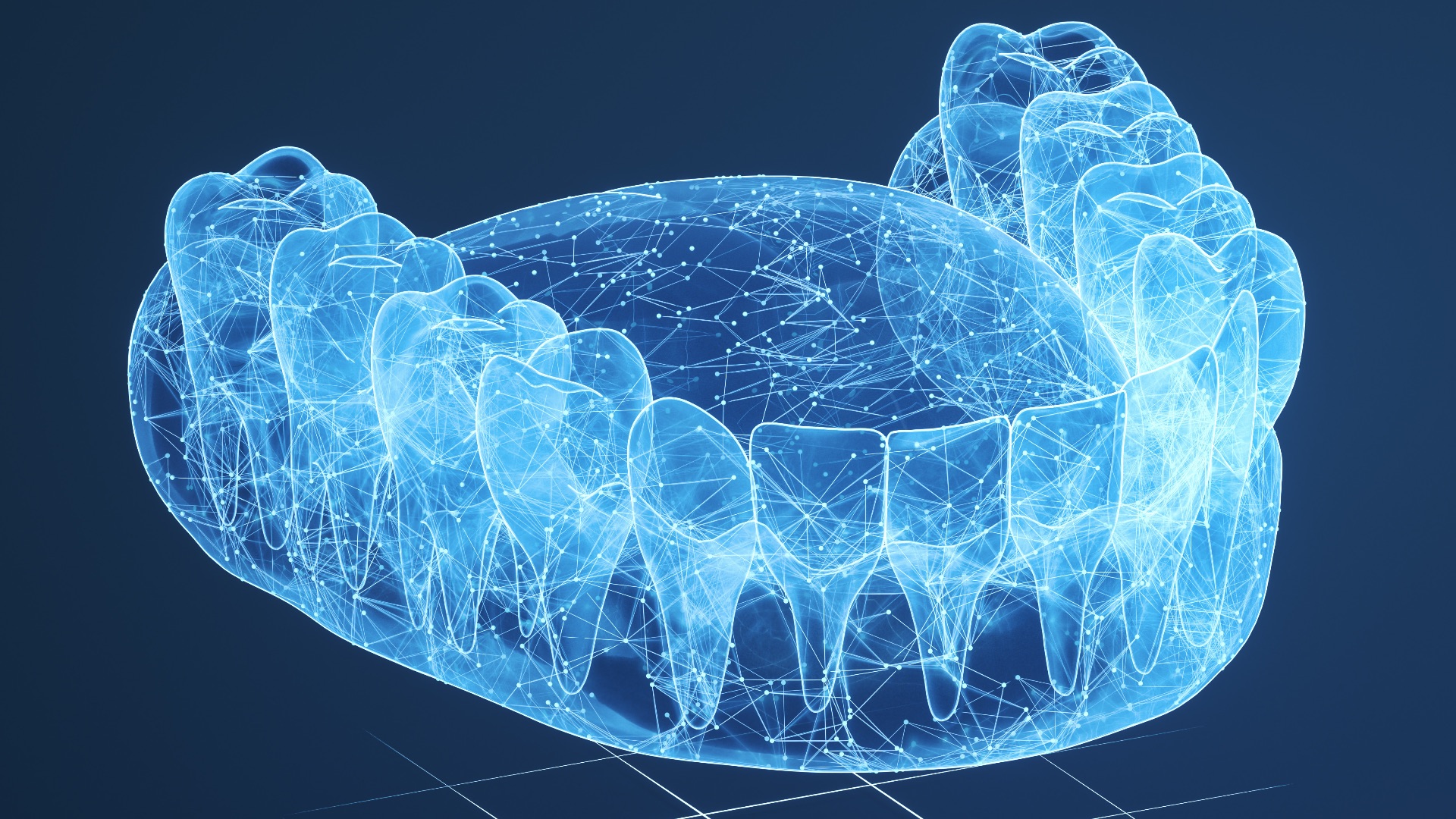 Contemporary Digital Denture Workflows
