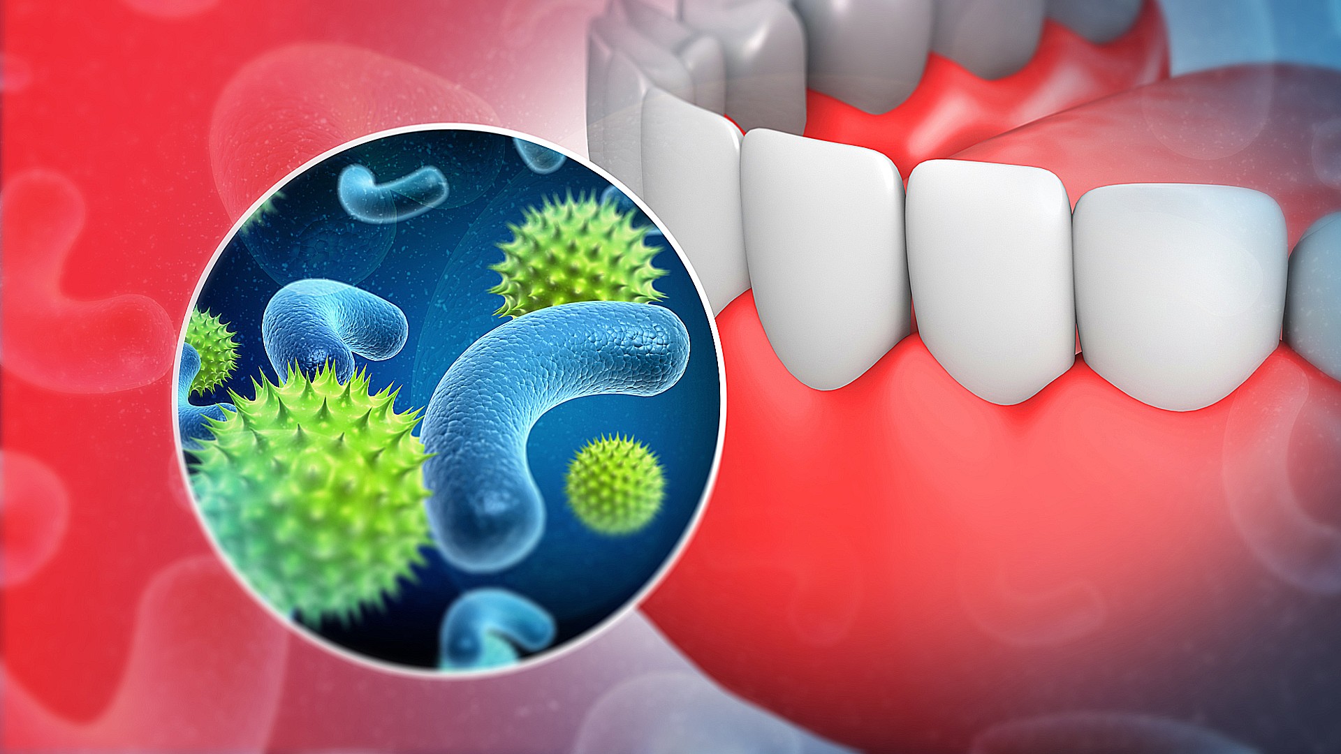 Bridging Microbial Ecology and Clinical Research to Optimize Periodontal Treatment and Prevent Implant and Restorative Failures