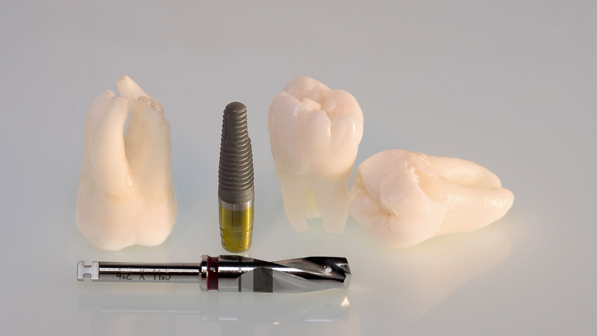 Tooth Retention vs. Tooth Extraction and Implant Placement